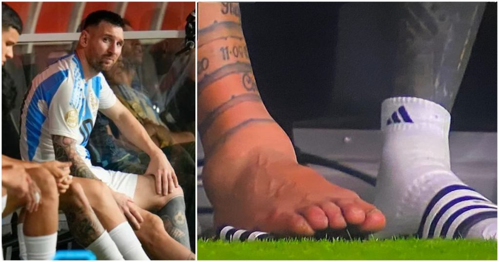 Messi Foot Inury From Glory to Agony: Lionel Messi Injured During Argentina's Copa ...